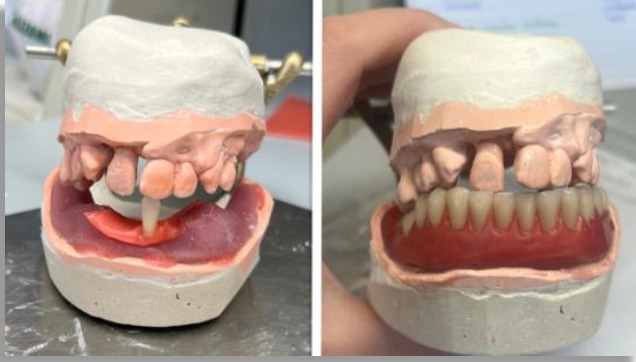 Zahntechnik in Málaga